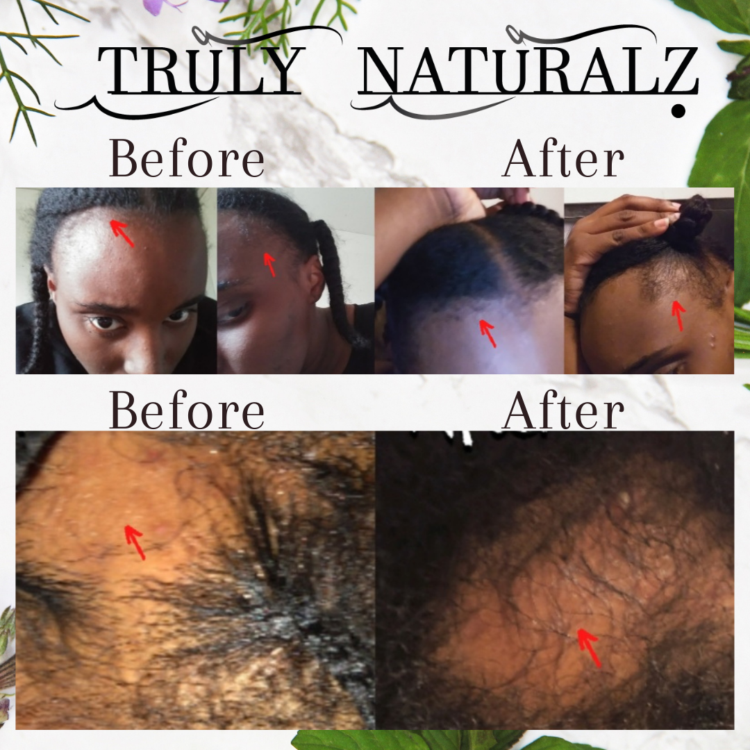 Balding MAXIMUM STRENGTH Rapid Growth Oil